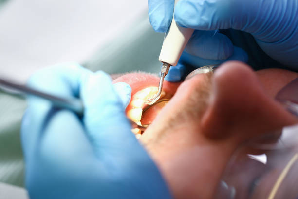 Best Emergency Dental Care for Sports Injuries in Baldwin, PA