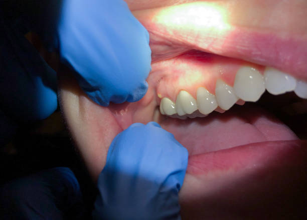 Best Emergency Treatment for Jaw Pain or Injury in Baldwin, PA